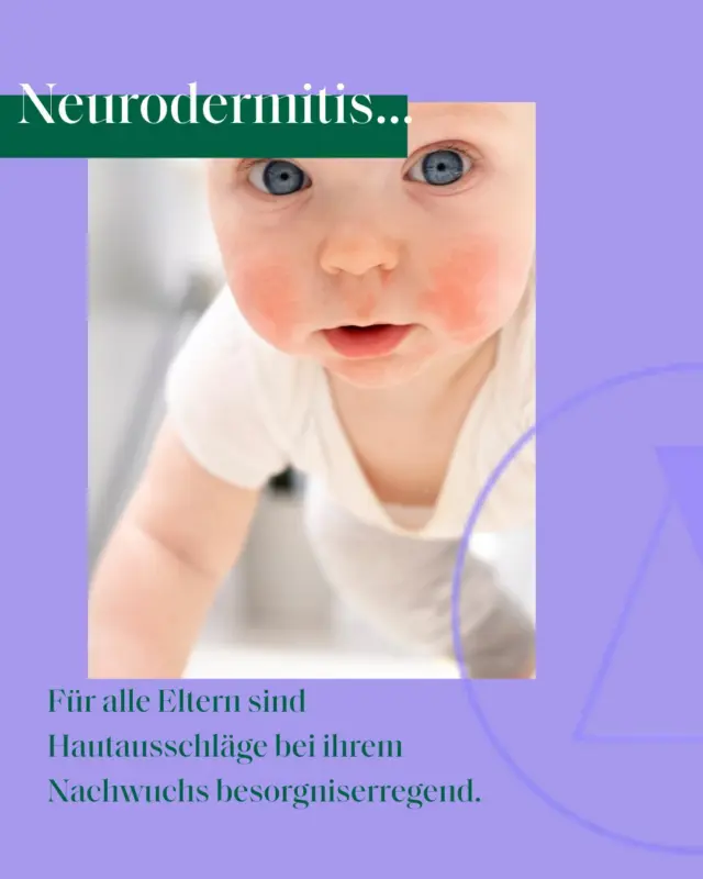🤱 Was tun, wenn dein Baby plötzlich rote Flecken bekommt?
Viele Eltern kennen es: Plötzlich zeigt sich ein Ausschlag – und die Sorgen beginnen. Ist es nur Wärme? Eine Allergie? Oder doch etwas Ernsteres?

In unserem neuen Blogartikel erklären wir die häufigsten Ursachen für Hautausschläge bei Babys – und was du tun kannst.

📖 Mehr Tipps + Ursachen im neuen Blogartikel 👉 Link in Bio!

#kamihilft #neurodermitis 
#babywissen #hautpflege #mamablog #kamiSkincare