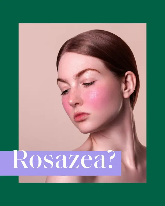 🖊 Feedback unserer Verwender (Beispielfoto): "Für Rosacea Patienten ist Ihr KAMI SSOS Balsam einmalig, ich habe nichts Vergleichbares gefunden. Ich hab nicht mehr mitgezählt, wie viele Cremes und Cortison ich verschrieben bekommen habe. Mittlerweile ist KAMI in meiner Morgenroutine nicht mehr wegzudenken. Ein wirklich großartiges Produkt."
💕Danke für das tolle Feedback!
#weloveourusers #rosazea #neurodermitis #problemhaut #kamihilft